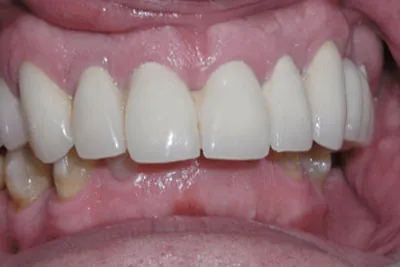 After image