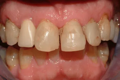 Before image