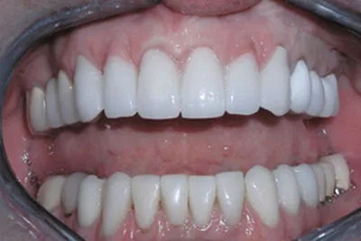 After image