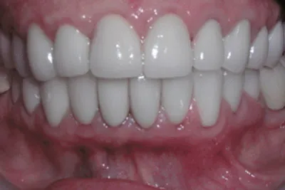After image