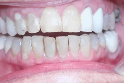 Before image