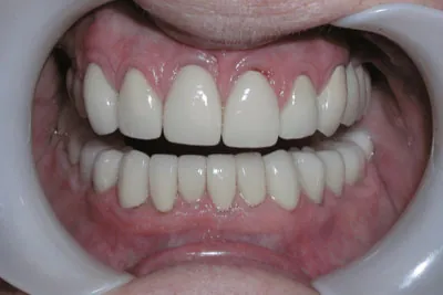 After image