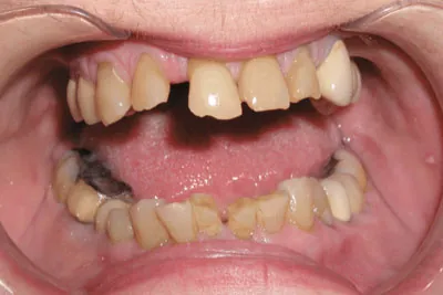 Before image