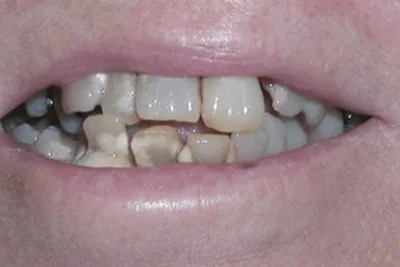 Before image