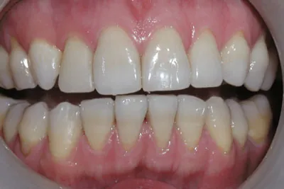 After image
