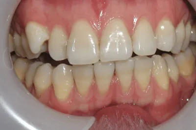 Before image