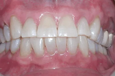 After image