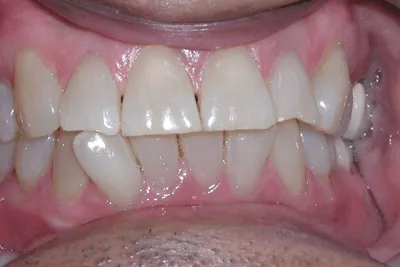 Before image