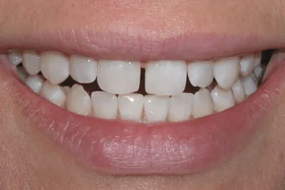 Before image