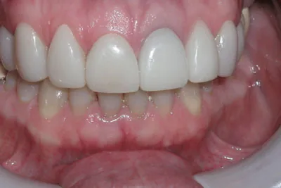After image