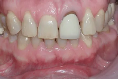 Before image