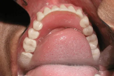 Before image