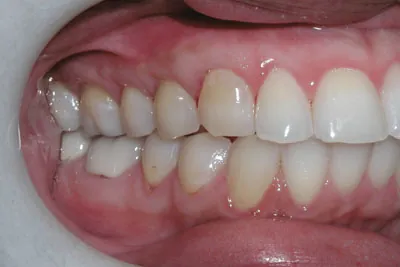 After image
