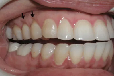 Before image
