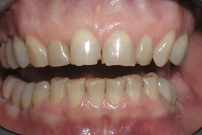 Before image