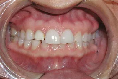 Before image