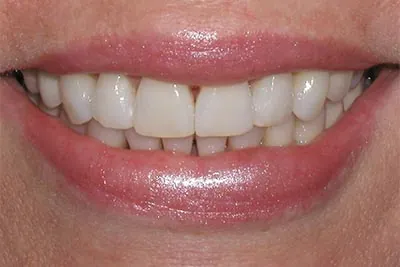 After image