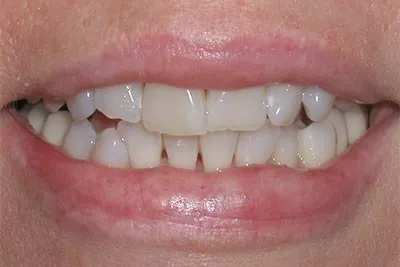 Before image