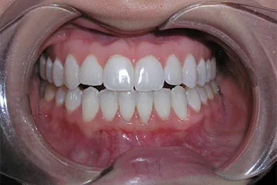 After image