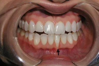 Before image