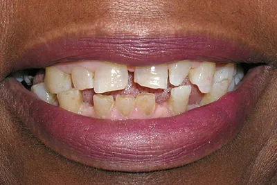 Before image