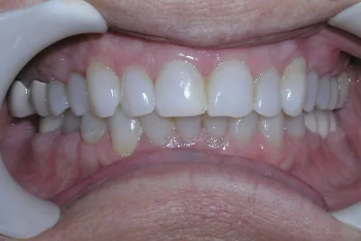 Before image