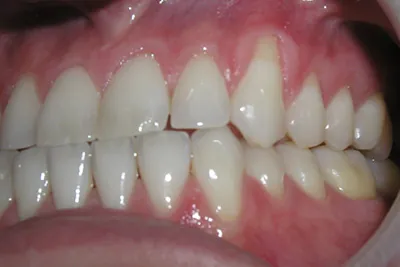 Before image