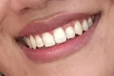 After image