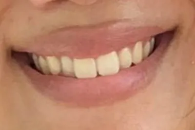 Before image